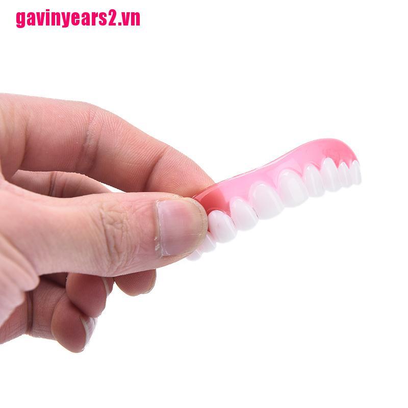 Răng Giả Trên Gav2 Màu Trắng Hoàn Hảo