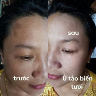 Mặt  nạ tảo biển n (cấy trắng da mặt)