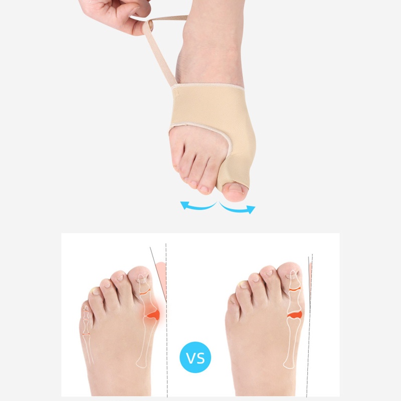 1 Cặp Đai Nẹp Chỉnh Hình Ngón Chân Cái Giảm Đau Dùng Khi Ngủ Dành Cho Nam Và Nữ YOUYO