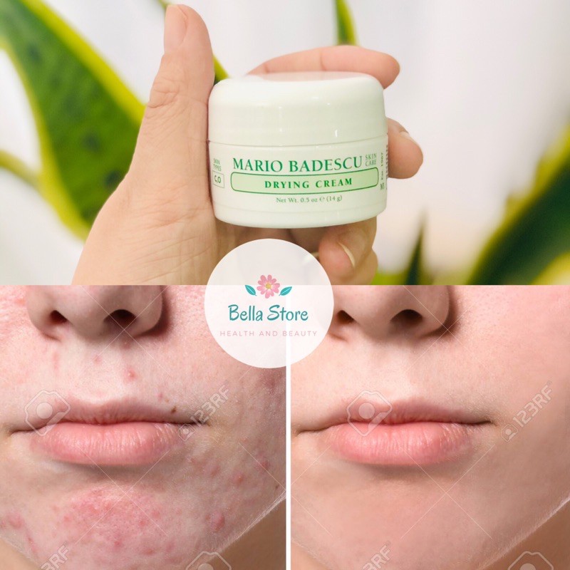 Kem giảm mụn diện rộng Mario Badescu Drying Cream an toàn cho phụ nữ mang thai