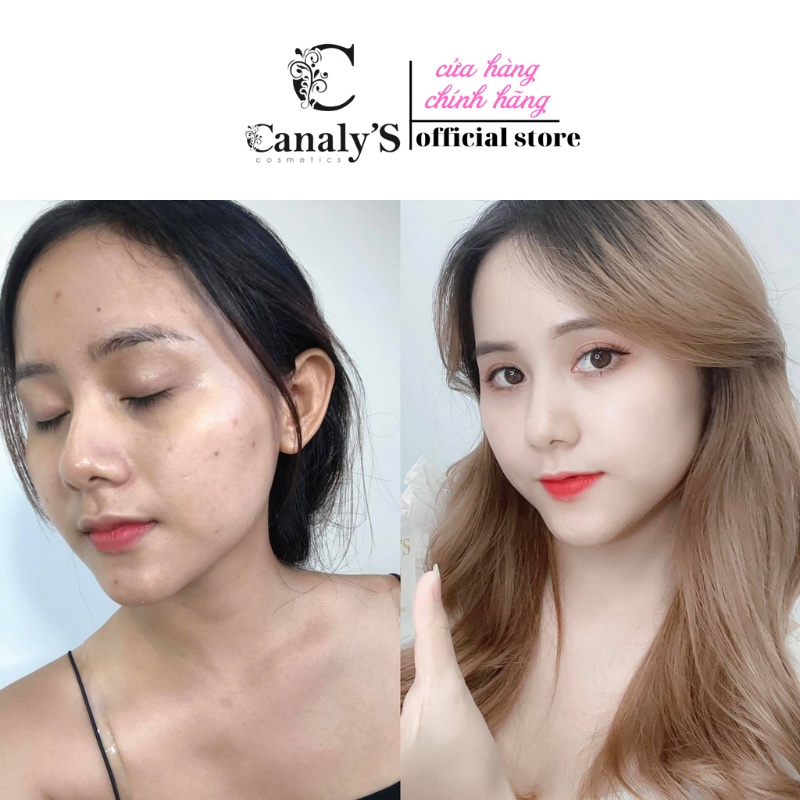 Serum mụn canaly,s Acosmetics 35ml