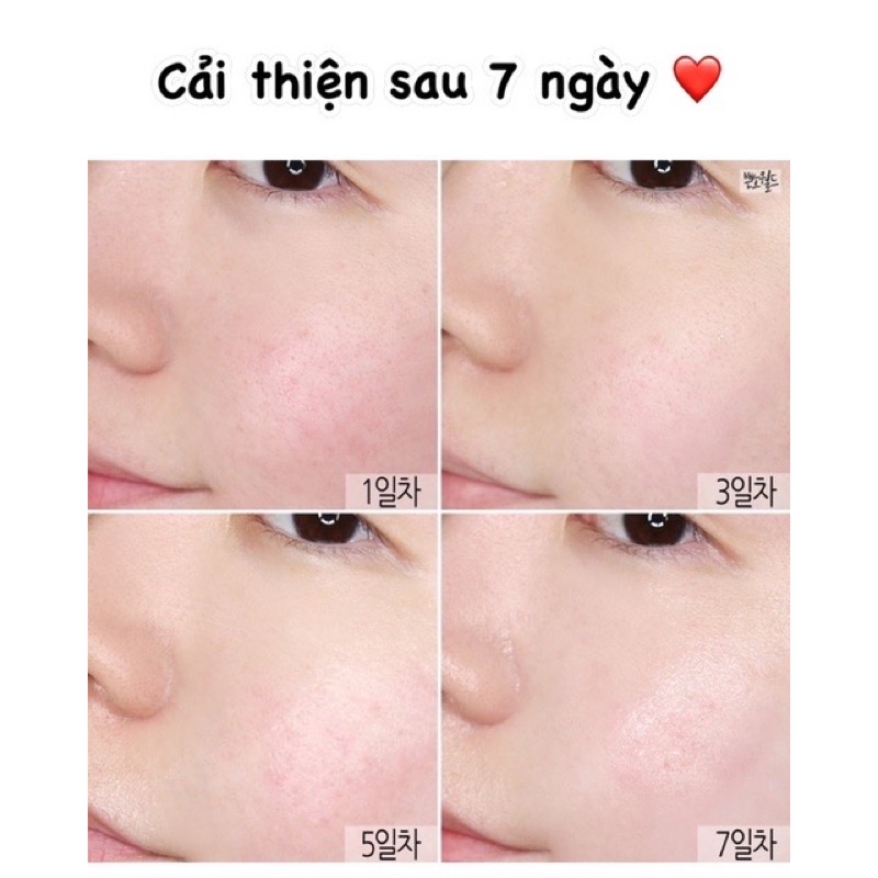 MIẾNG TẨY TRANG TẨY TẾ BÀO CHẾT Medi Jewelry black honey swab pad