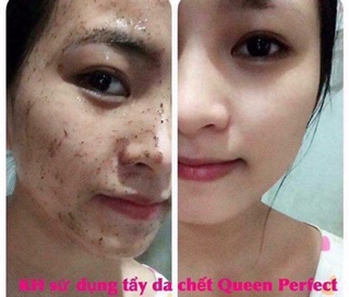 [ RẺ VÔ ĐỊCH] TẨY DA CHẾT CAFE QUEEN PERFECT