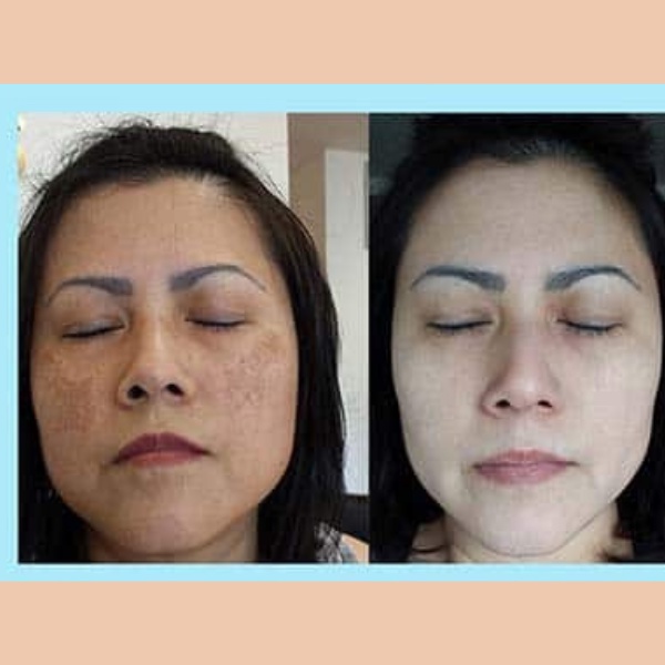 Vitamin e đỏ 400 viên uống đẹp da giảm nám mờ nhăn chống lão hoá