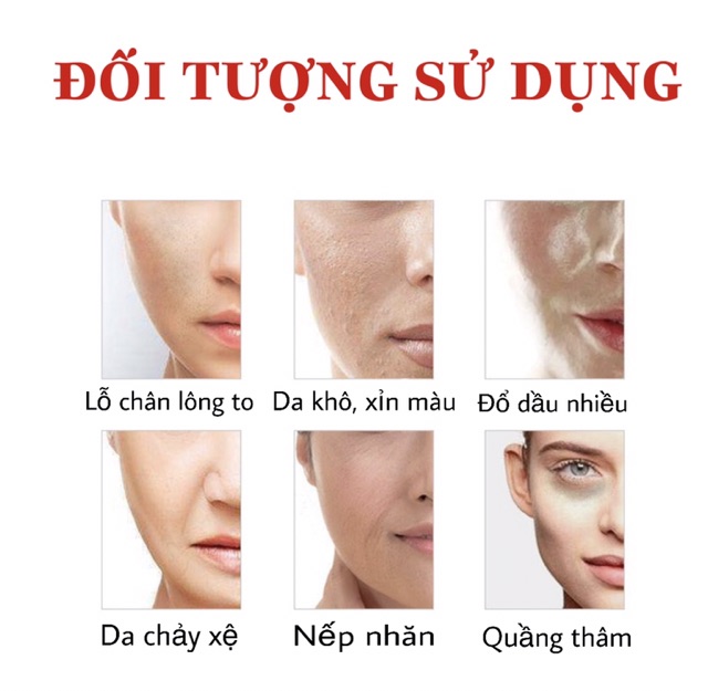 Máy điện di tinh chất MRSXIE Hàng Chính Hãng Cầm Tay Nâng Cơ Làm Sạch Đẩy Dưỡng Chất Massage Mắt genie D818 ILIFT | BigBuy360 - bigbuy360.vn