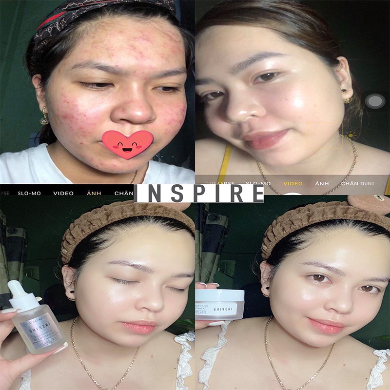 Serum Inspire Tinh chất Trái Cây Cô Đặc, Dưỡng Trắng Da, Phục hồi da hư tổn, An toàn cho mọi loại da