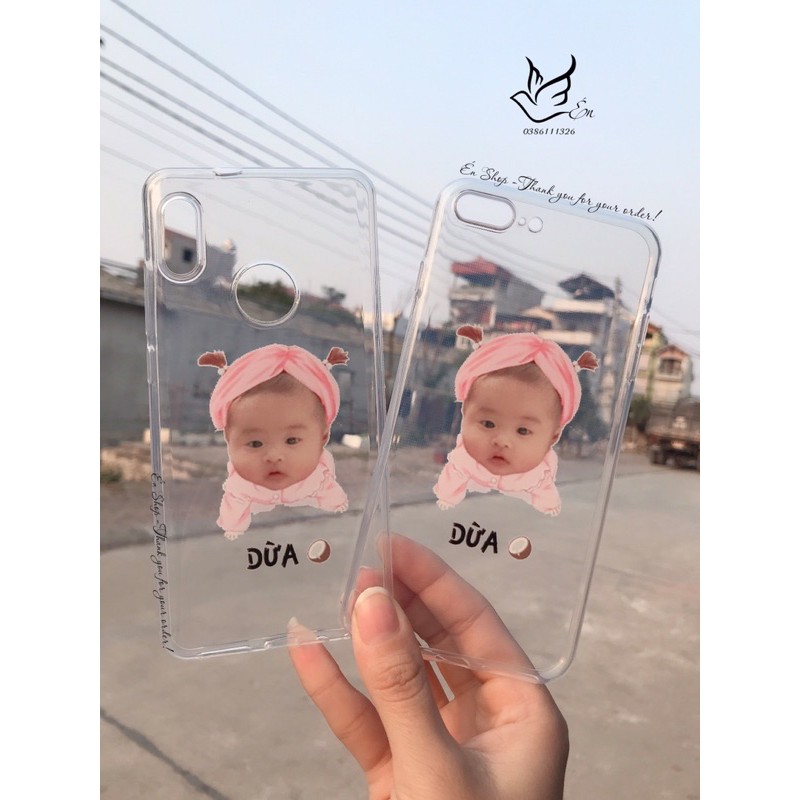 Ốp thiết kế hình siêu cute cho bé yêu theo yêu cầu nhiều mẫu