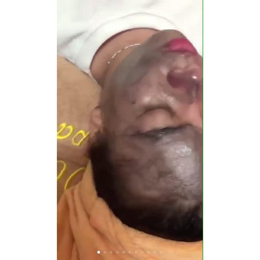 Viên Thải Chì, Viên Tẩy Chì Haosani Dùng Cho Máy Thải Chì, Thải Độc Tố Da Mặt - Thẩm Mỹ Huyền Trang NANOCEE | BigBuy360 - bigbuy360.vn