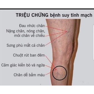 Viên Uống Tĩnh Mạch Ven