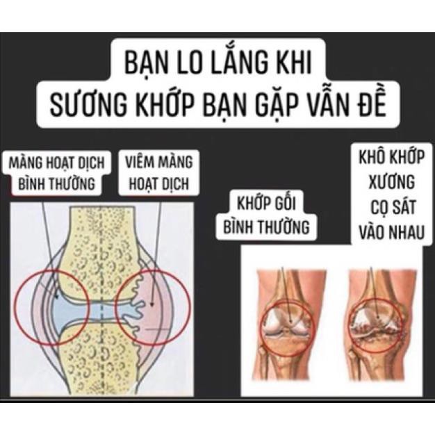 CAO BÔI XƯƠNG KHỚP - HÀNG CHUẨN CHẤT LƯỢNG CAO