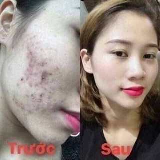 (Chính hãng) Kem dưỡng da Collagen Plus vit E