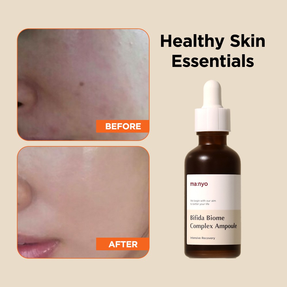 MANYO FACTORY Bifida Biome Complex Ampoule 50ml | BigBuy360 - bigbuy360.vn