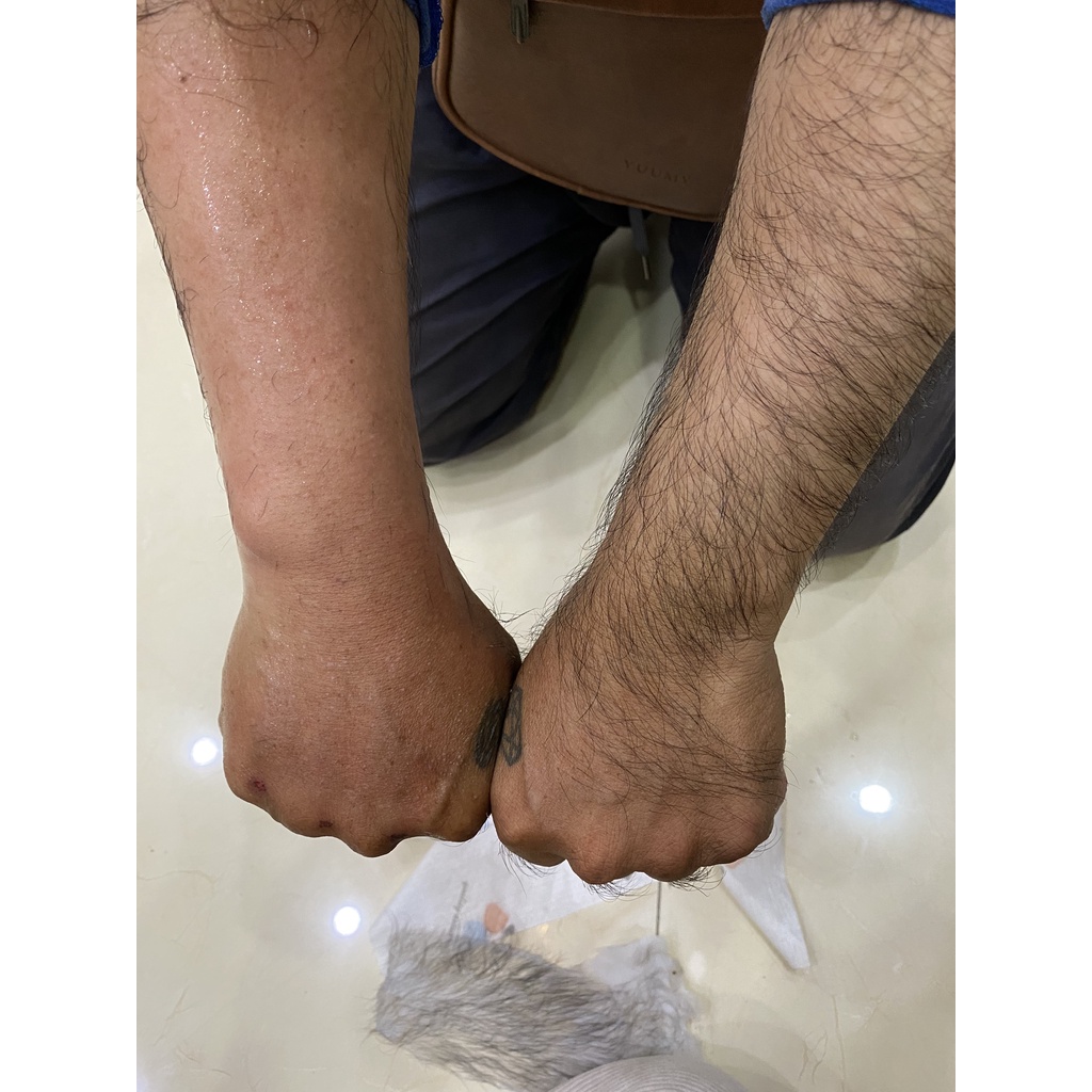 Combo Wax Lông Nồi Chống Dính Nấu Sáp - Sáp Premium Coconut - Mỡ Trăn (90ml) - 5 Que Gạt Sáp Cao Cấp