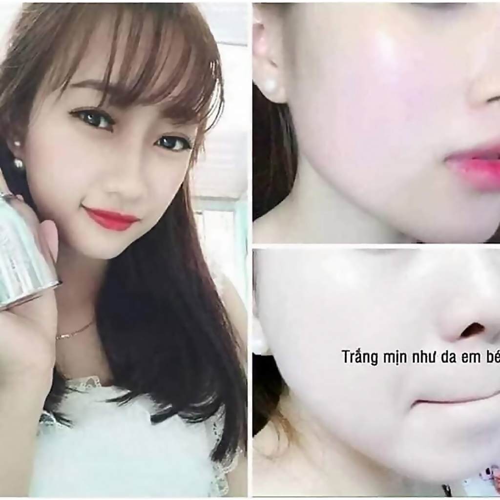 Kem Sữa Dưỡng Trắng Da Mặt, Cấp Ẩm, Ngừa Lão Hóa, Cân Bằng Da The Perfect Whitening Cream Plus Chính Hãng Linh Hương 30m