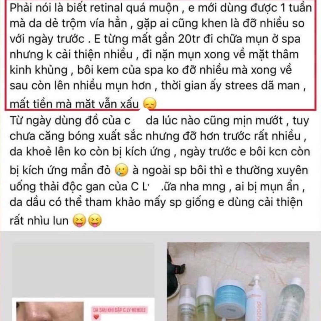 Kem Retinal 1% Lumiderm Retinal Advanced - A 1.0 Cream