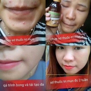 (tunv90) thảo dược đông y lê xuân