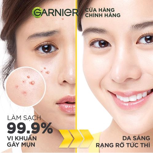 Sữa Rửa Mặt 3 Trong 1 Giảm Mụn, Dưỡng Sáng Da Garnier Bright Complete 3-in-1 Anti-Acne Foam