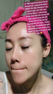 Redpeel Tingle Serum mẫu thử 5ml
