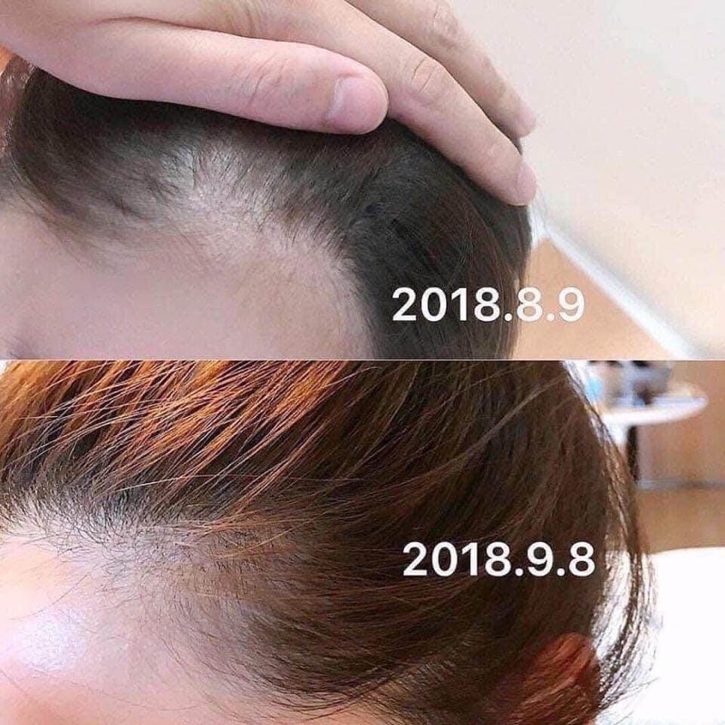 Dung dịch Sato giúp mọc tóc Nhật Bản