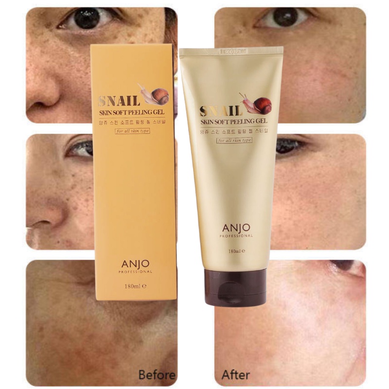 Gel Tẩy tế bào chết da mặt ốc sên Hàn Quốc làm sạch sâu dưỡng ẩm ANJO 180ml