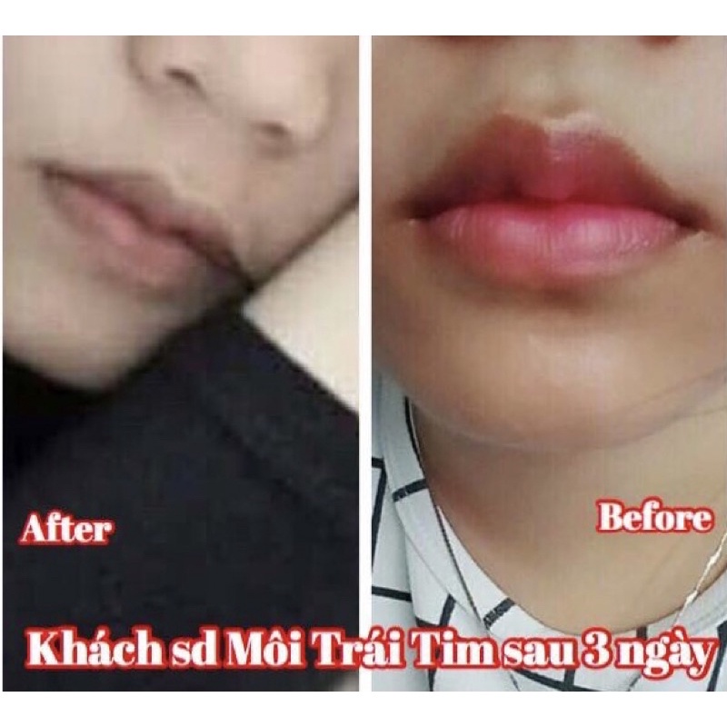 Tinh chất Miracle Pháp tạo môi trái tim và làm dầy môi sexy (10ml)
