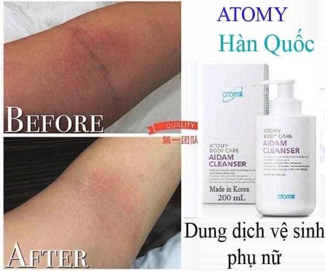 [CHUẨN HÀN QUỐC] DUNG DỊCH VỆ SINH NAM NỮ HÀN QUỐC[BẢO HÀNH 30 NGÀY][THIÊN NHIÊN][FREESHIP