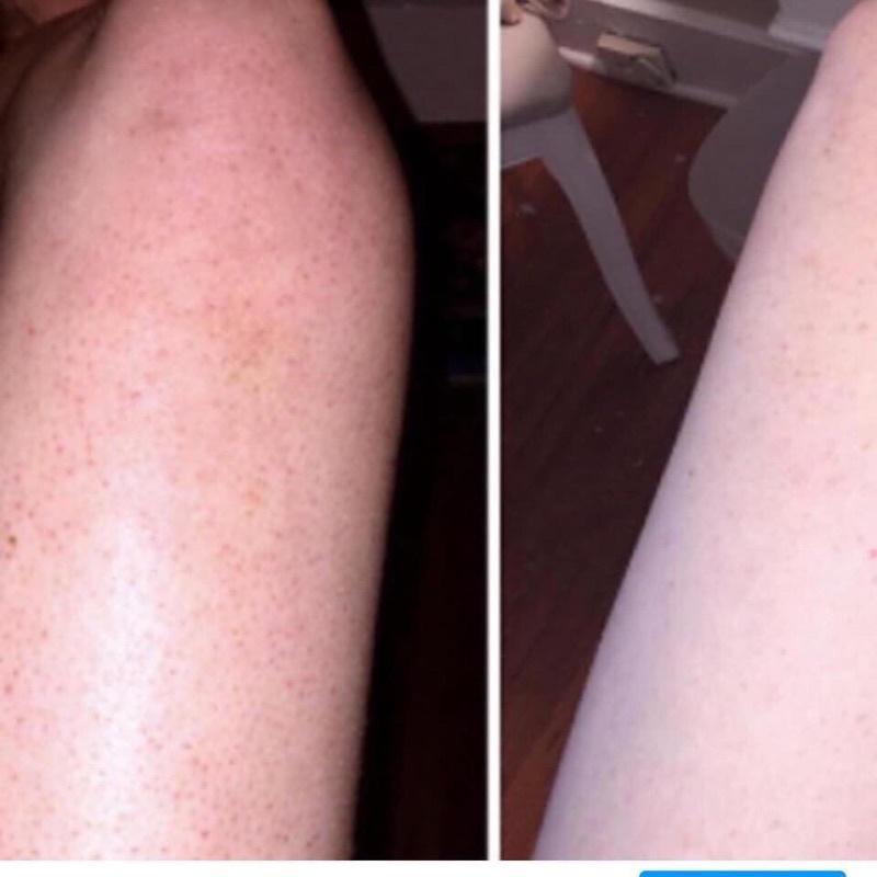 Lotion dưỡng da toàn thân Amlactic Daily Body Lotion 567gram