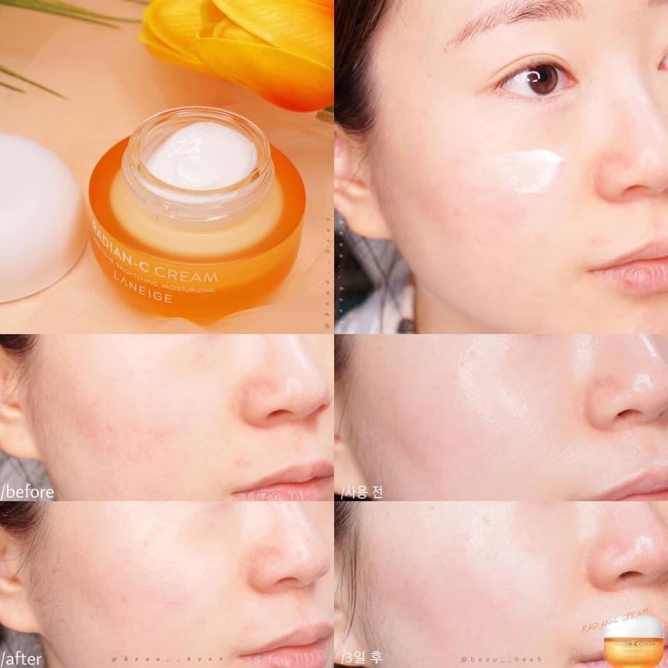 Kem Dưỡng Ẩm, Dưỡng Trắng Da Mờ Thâm Nám Laneige Radian-C Cream