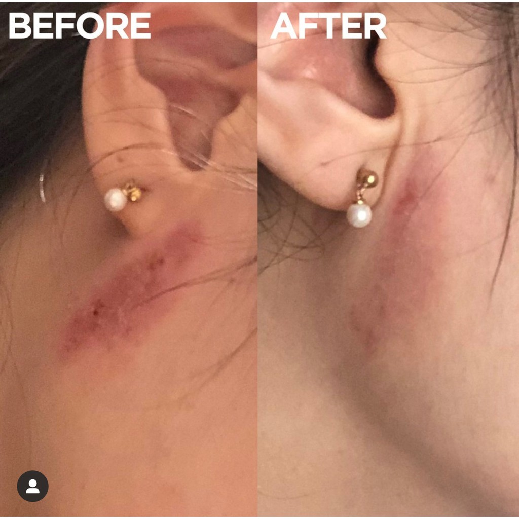 Lanolips Golden Salve - Kem dưỡng cho da siêu khô/bệnh từ Lanolin