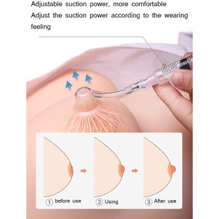 Chữa đầu ti thụt, ngắn,lõm Nipple  Corrector hiệu quả vĩnh viễn