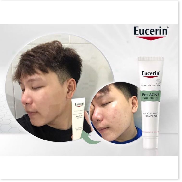 Tinh Chất Giảm Mụn, Mờ vết Thâm Eucerin Acne-Oil Control Pro Acne Solution A.I Clearing Treatment 40ml