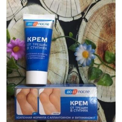 [FREESHIP] KEM NỨT GÓT CHÂN KPEM _ KEM NỨT GÓT CHÂN NGA