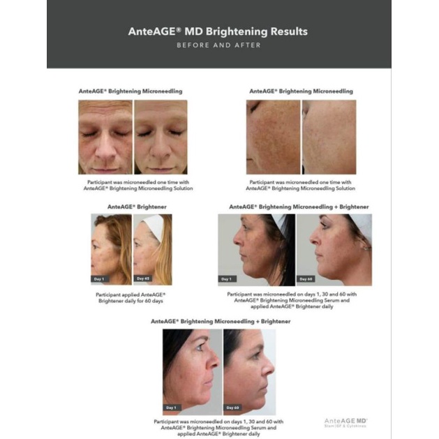 AnteAGE MD Brightener Dưỡng Sáng Trắng Sáng Mạnh, Giúp Làn Da Sáng Khoẻ