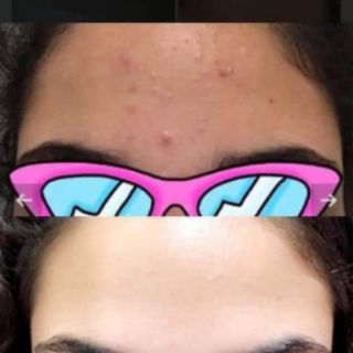 Kem dưỡng ẩm Retinol A313 (có bill)