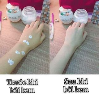 Kem dưởng trắng body kbone