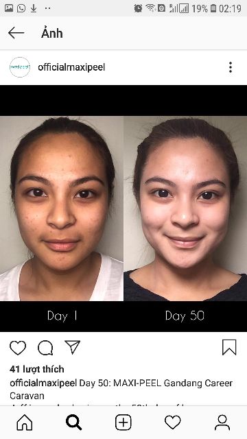 Xà phòng maxi peel sạch da