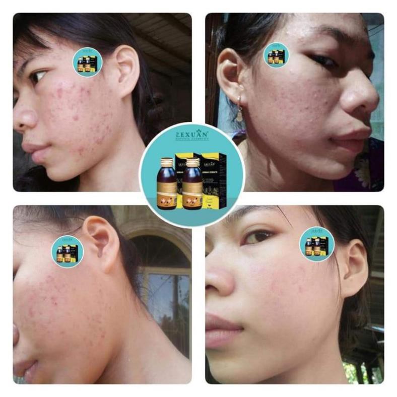 Thảo Dược Đông Y Lê Xuân Handmade( L/130ml) | BigBuy360 - bigbuy360.vn