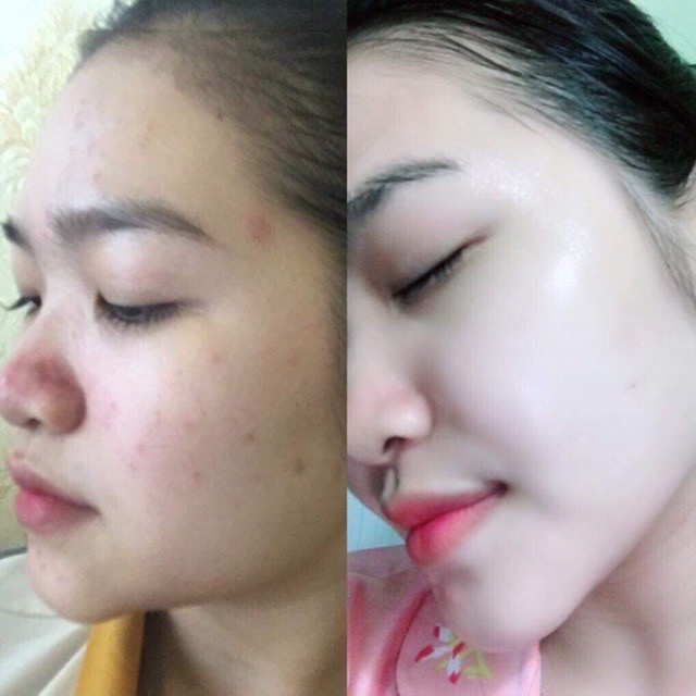Kem Face A  + Serum A  Dưỡng Trắng Da Mềm Mịn Căng Bóng