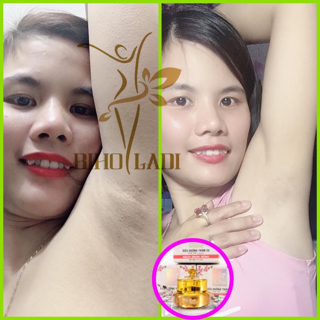 Combo BIHO LADI siêu dưỡng thâm 5s [mua 2 được 4] | BigBuy360 - bigbuy360.vn