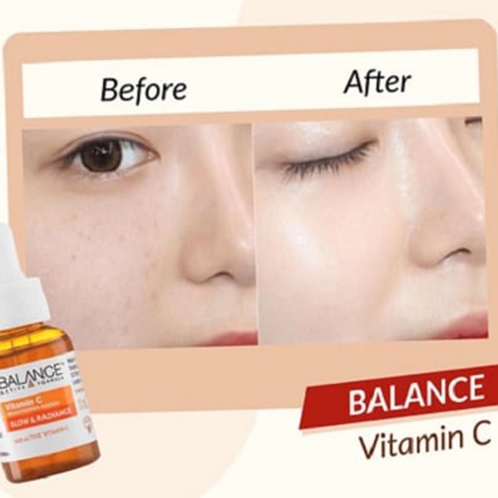 Serum Balance Ngừa Mụn, Sáng Da, Mờ Thâm, Dưỡng Ẩm Vitamin C, Hyaluronic, Niacinamide 30ml