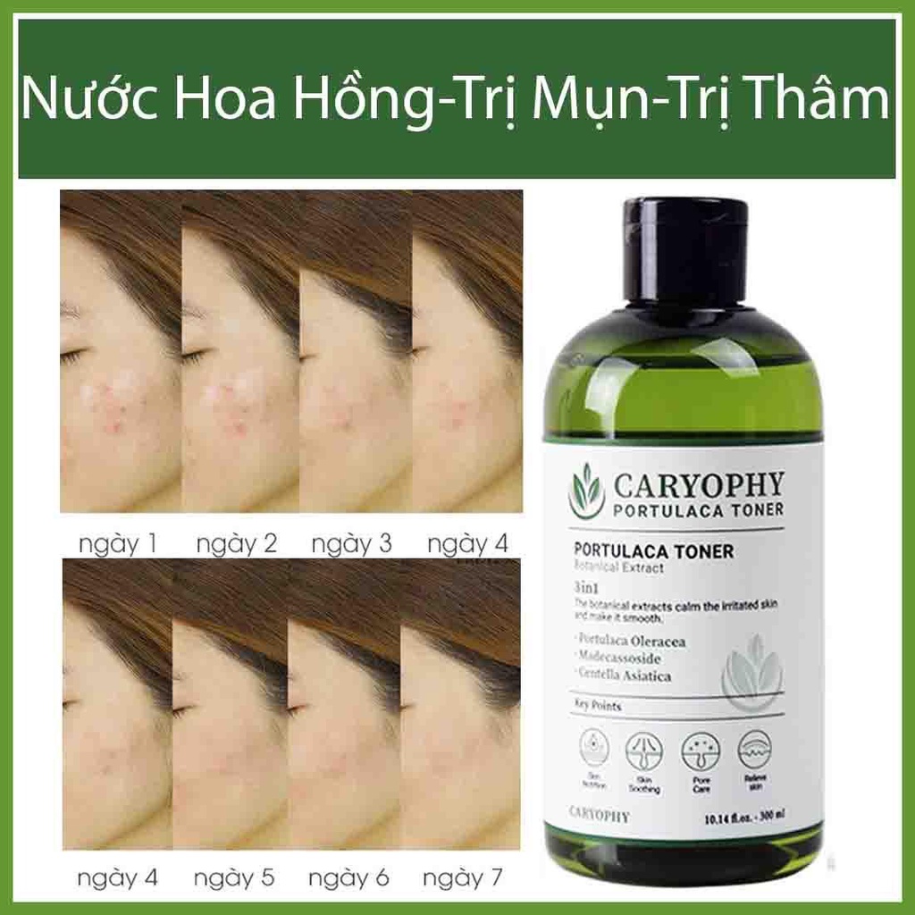 Combo Giảm Mụn, Làm Dịu Da  Caryophy Portulaca ( Toner 300ml + Serum 10ml)