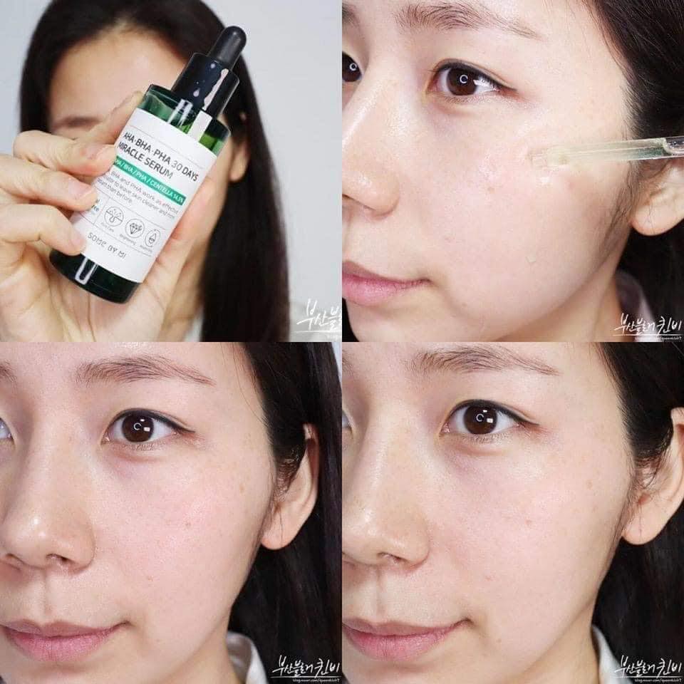 Serum trị mụn AHA BHA PHA 30DAY MIRACLE SERUM