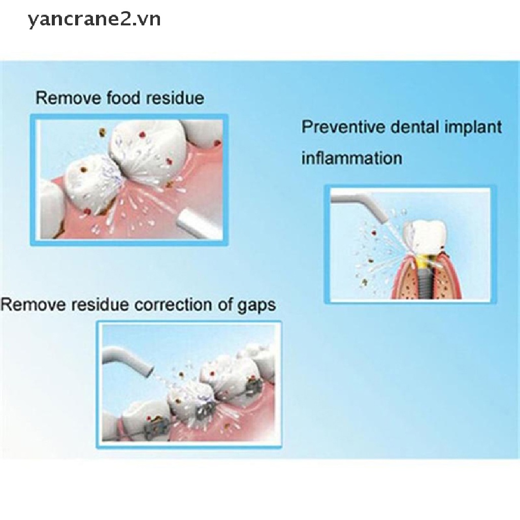(Hàng Mới Về) Dụng Cụ Vệ Sinh Răng Miệng Phun Nước Tiện Lợi Dễ Sử Dụng