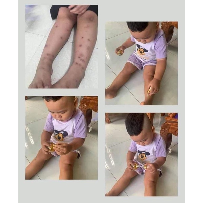 SERUM mờ thâm đa năng phúc minh tâm HÀNG CHÍNH HÃNG | BigBuy360 - bigbuy360.vn