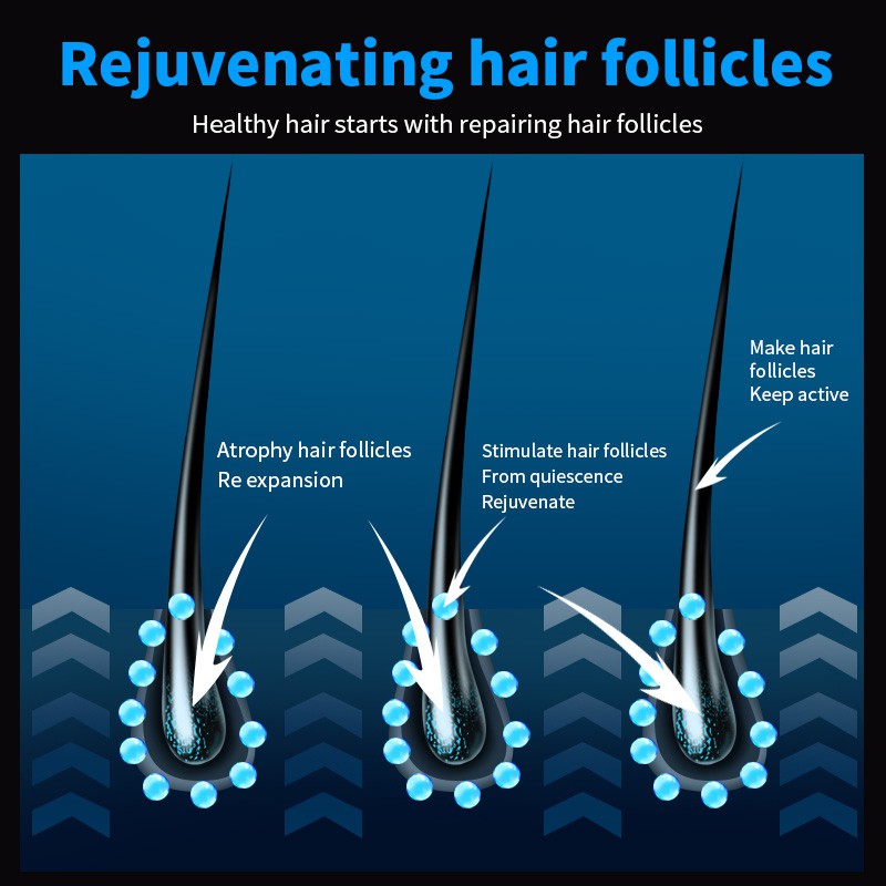 Tinh dầu Reagain dạng xịt giúp kích mọc tóc giảm rụng tóc hiệu quả cho nữ 60ml 100g