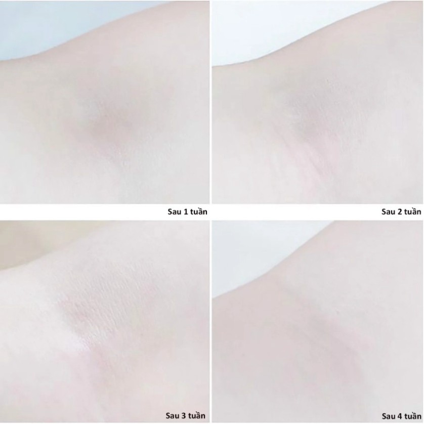 Kem Khử Mùi Tinh Chất Serum Sáng Mịn Dove Deodorant Dry Serum Collagen 50ml