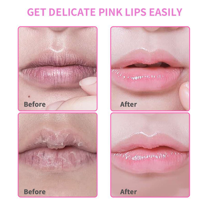 LIYAL'AN Bộ 10 Mặt Nạ Môi Chiết Xuất Collagen Dưỡng Ẩm Tẩy Tế Bào Chết