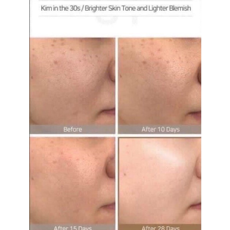 [Bill HÀN] Toner tẩy da chết 240ml Glycolic Acid 7% Toning Solution The Ordinary | BigBuy360 - bigbuy360.vn