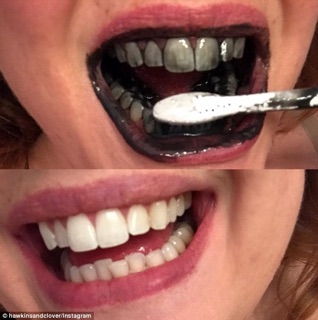 Teeth whitening 100% natural than hoạt tính trắng răng
