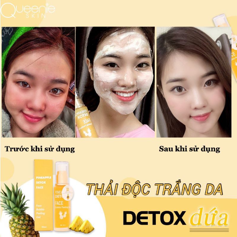 DETOX DỨA -THẢI ĐỘC DA MẶT QUEENIE SKIN